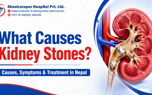 What Causes Kidney Stones? Causes, Symptoms & Treatment in Nepal
